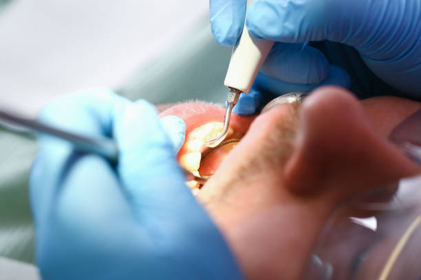 Best Emergency Treatment for Toothache in Fulton, TX
