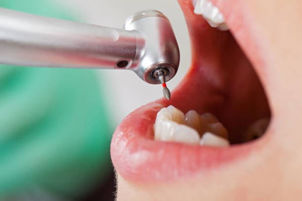 Best Urgent Dental Care in Fulton, TX